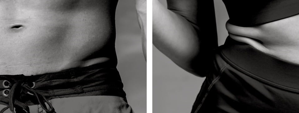 jfg clinic spécialiste de la minceur