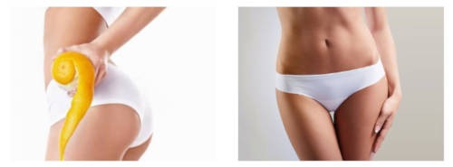 silhouettes Relooking